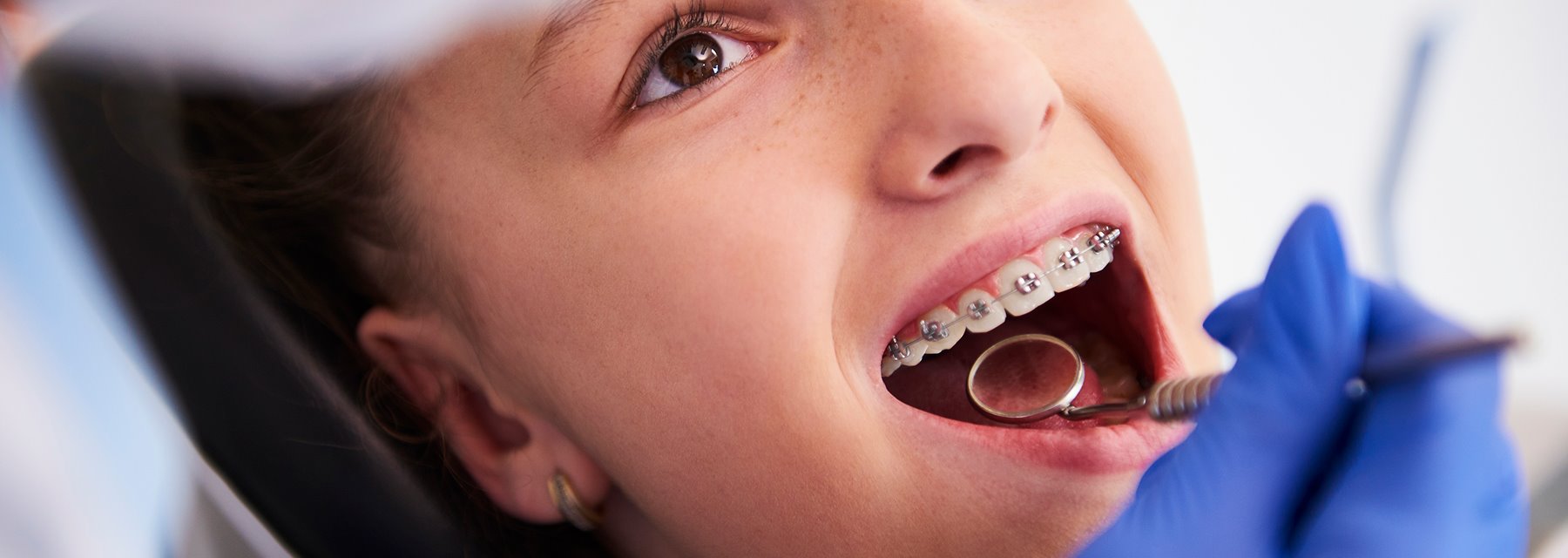 Dental Treatment by Green Orthodontics, Columbia, SC
